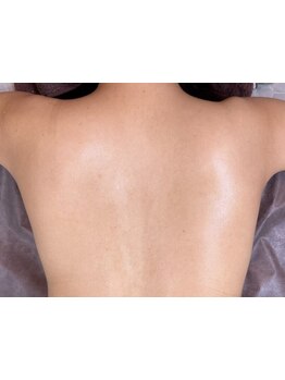 ブライダルメニューがあるサロン