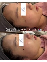 ユフラ(Juhla)/ララピール