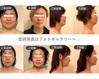 マリーボーテ 名古屋店