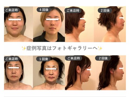 マリーボーテ 名古屋店の写真