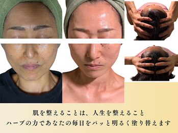 スカイ(sky)/エクソソームハーブピーリング