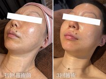 ダナン(danan)の雰囲気（韓国女優のような水光ピーリングうるおい満ちる艶肌へ）