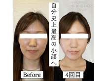 サニー(SUNNY)の雰囲気（結果重視★艶肌小顔効果を体感下さい！肌質改善/肌育/小顔整体）
