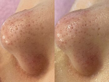 メゾン ド エム(maison de M)/