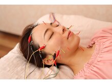 メイロン(meilong)/美容鍼灸