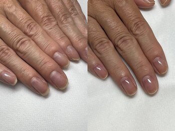 ハンドケア・ネイルケア