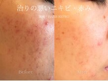 エメ(Aimee)/HAAB REPRO