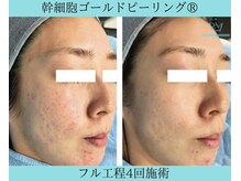 リメイククリニカルビューティー(Remake clinical beauty)/