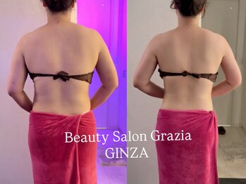 グラツィア 銀座(Grazia)/6回【 ブライダルエステ整体 】