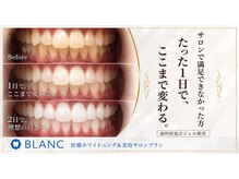 ギンザエクランの雰囲気（提携サロンにてギンザエクラン内でホワイトニング可能！）