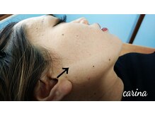 ブラジリアンワックスサロンカリーナ(Carina)/フェイスワックス