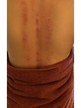 珍雲堂 本店/カッサ、気持ちいいですよ！