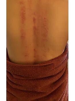 珍雲堂 本店/カッサ、気持ちいいですよ！