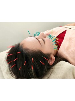 ホウレイ線・たるみ改善！予防ケア