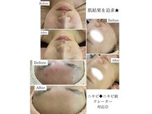 ディアマンジュ 岐阜店(Diamange９)の雰囲気（～オイリー/敏感/ニキビ/シミ/乾燥など幅広くお悩みを改善～）