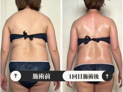 シーアンル(C.aneL)の写真