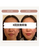 あいここ/お客様ビフォーアフター