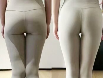アイラ 葛西駅前店(EYELA)の写真/骨盤底筋ケア8000円～でO脚X脚改善、すらっと美脚美尻に♪尿漏れでお悩みの方やフェムケア、産後の方にも◎