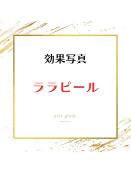エイシスグロウ(asis glow.)/ララピール