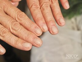 自爪育成(自爪風仕上げ)