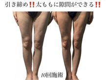 痩身革命 大宮店/ダイエットリンパマッサージ