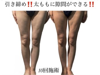 痩身革命 大宮店/ダイエットリンパマッサージ