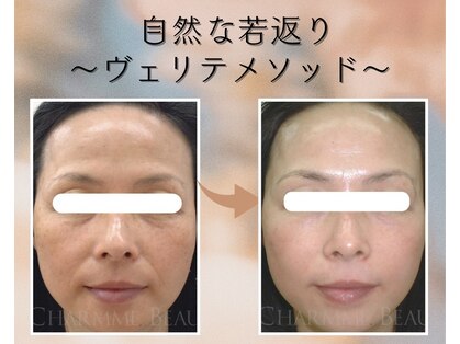 ル シェノン(Le Chainon)の写真