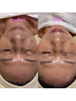 リボーン(be reborn)/