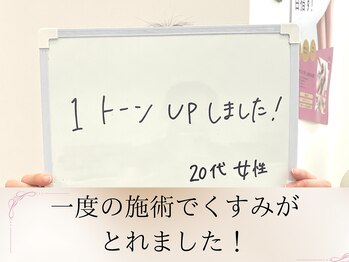 エステサロンパリス(Esthe Salon Paris)/くすみも取れて嬉しいですね♪