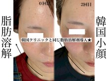 リベルキョウト 京都駅前店(Liber Kyoto)/レモンボトル超え!二重顎撃退