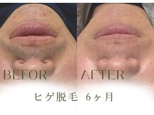 マグノリア(MAGNOLIA)の雰囲気（毎日の髭剃りから解放！）