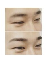 アイビー 神保町店(i.b)/眉【before⇒after】８