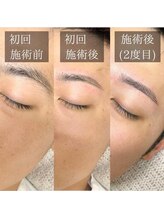 エストアール 筑紫口本店(est-r.)/#メンズアイブロウ