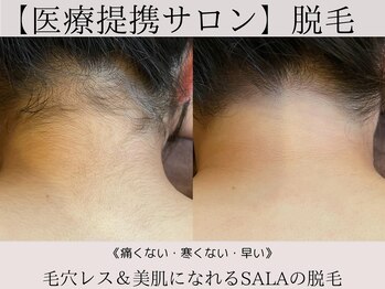 サロンドボーテ サラ(salon de beaute SALA)