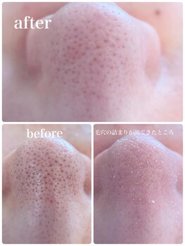 ルウ(Ruu.)/韓国式3D毛穴洗浄