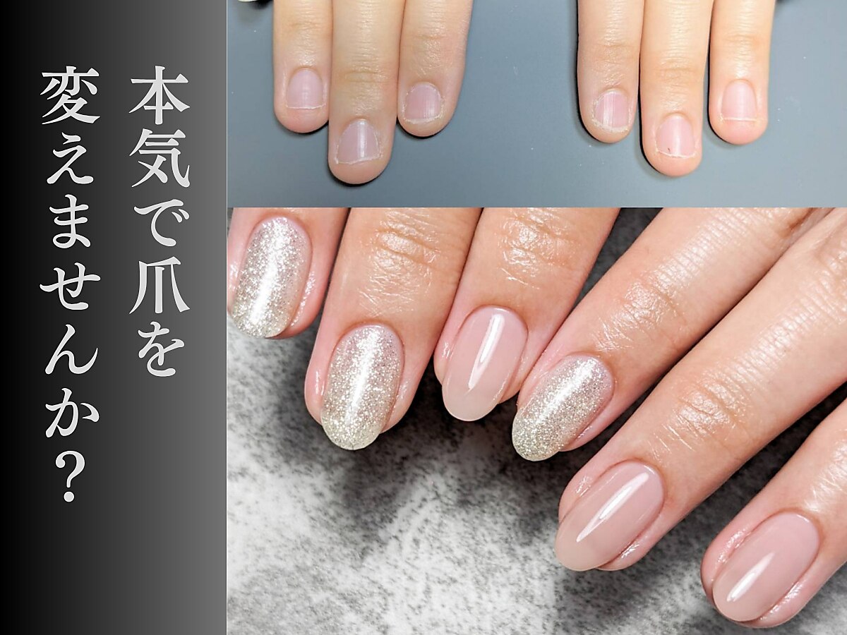 ジップス(zips)｜ホットペッパービューティー
