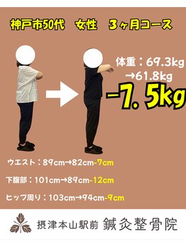 摂津本山駅前鍼灸整骨院/特に辛さもなくダイエット成功！