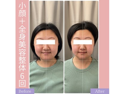 キアラ(chiara)の写真