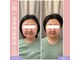 キアラ(chiara)の写真