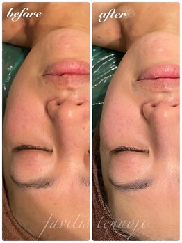 ファビリス 天王寺店(FAVILIS)/ハーブ3グラム1回/40代