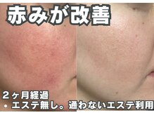 フェイス(FACE)