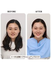 シュアリー(Surely)/ペアトータルコースお客様事例