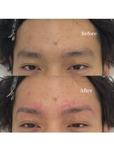 モテテ 名駅店(motete)/お客様施術例☆名駅