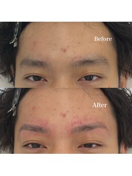 モテテ 名駅店(motete)/お客様施術例☆名駅