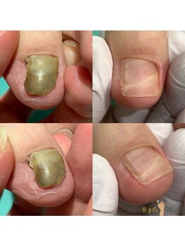 巻き爪補正店 那覇店/