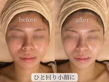 サロンハート(Salon Heart)/浦和エステ痩身/小顔/よもぎ蒸し