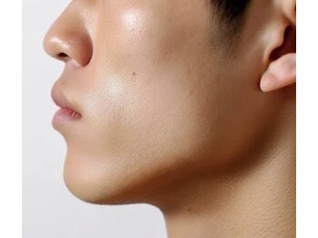 ダブリューアイビューティー 池袋店(W EYE BEAUTY)の写真/【新規平日限定】全顔＋保湿仕上げ6980円/初めての方や脱毛サロン選びにお悩みの男性にオススメ♪[池袋]
