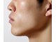 ダブリューアイビューティー 池袋店(W EYE BEAUTY)の写真/【新規平日限定】全顔＋保湿仕上げ6980円/初めての方や脱毛サロン選びにお悩みの男性にオススメ♪[池袋]