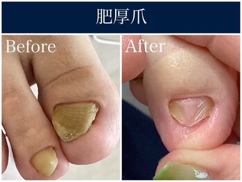 ドクターネイル爪革命 麻布十番店