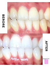 エクシアホワイトニング 王寺店/